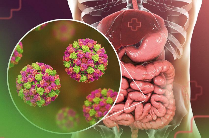  Norovírus: doença tem se proliferado no país, causa gastroenterite